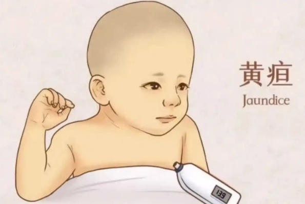医疗认知的局限性导致以前黄疸没人管