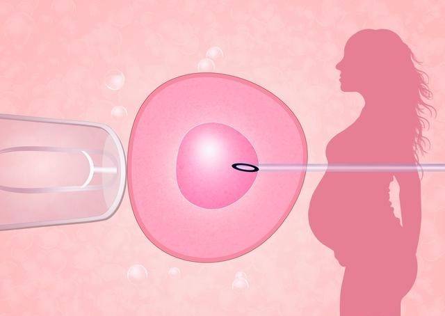 做试管婴儿，为什么会有自然周期促排卵呢？
