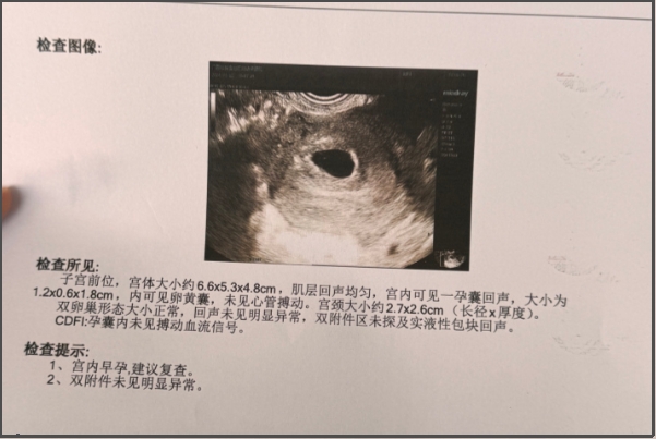 胎停后又活了可能是机器出现问题