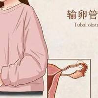 第三代试管婴儿的全部流程及费用：多少钱？价格明细过来人帮你梳理