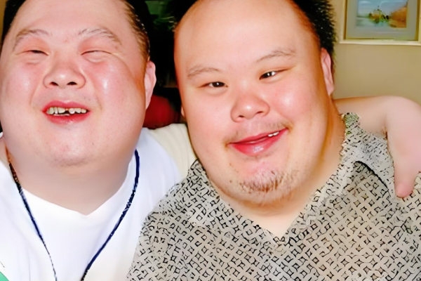 唐氏儿存在遗传倾向