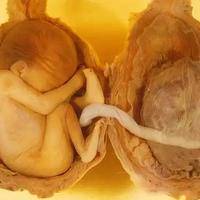 双胞胎一个停育后复活?真相是别误判发育信号