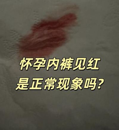 内裤上怎么看出怀孕？这3个变化比着床出血更值得看