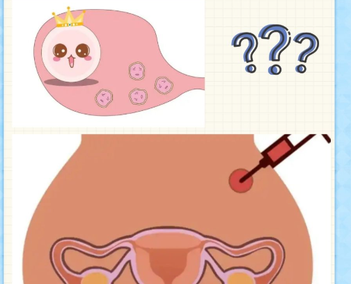 多次促排是正常的
