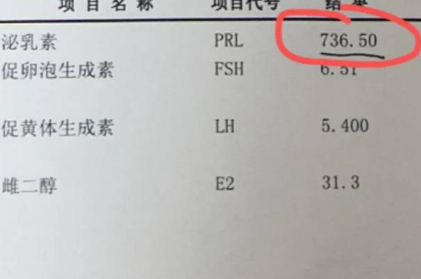 女性泌乳素高不影响精子质量