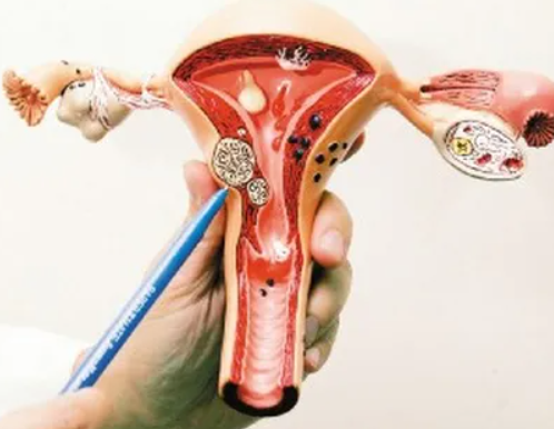 功能性子宫出血有哪些症状，异常出血能做试管吗？