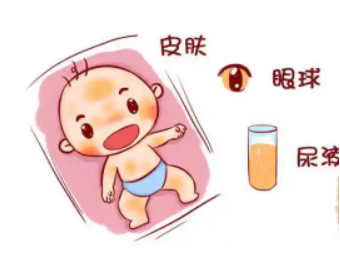 黄疸婴儿图片 症状图片
