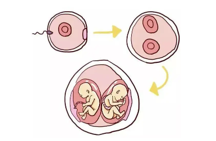 什么人容易怀单卵双胎,做试管怀上单卵双胎是身体好还是胚胎好