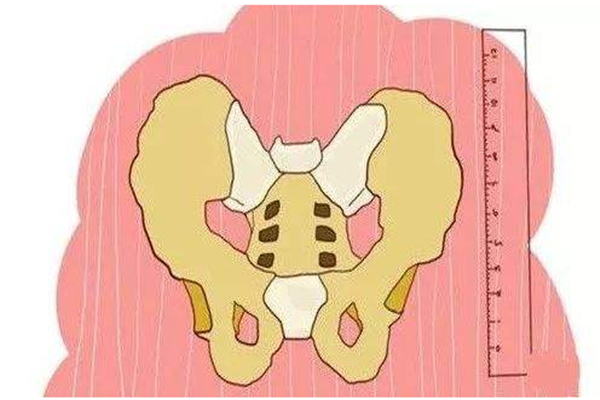 怎么看骨盆的大小