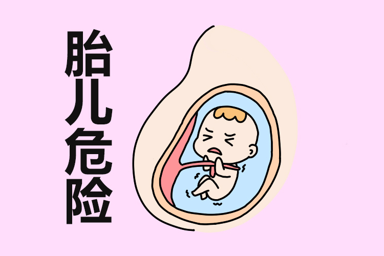 产检顺利却无缘无故动胎气皆因不注意3行为