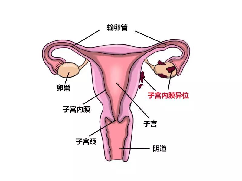 孕15周子宫位置示意图图片
