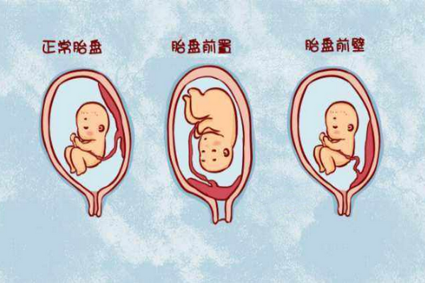 子宫前位受孕图解法图片