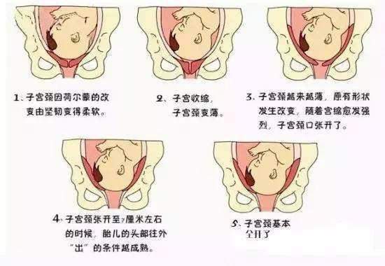 孕晚期孕妇6种感受明显,说明胎儿已经顺利入盆,附胎儿入盆图解