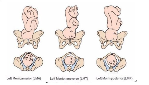 左骶前胎位图片