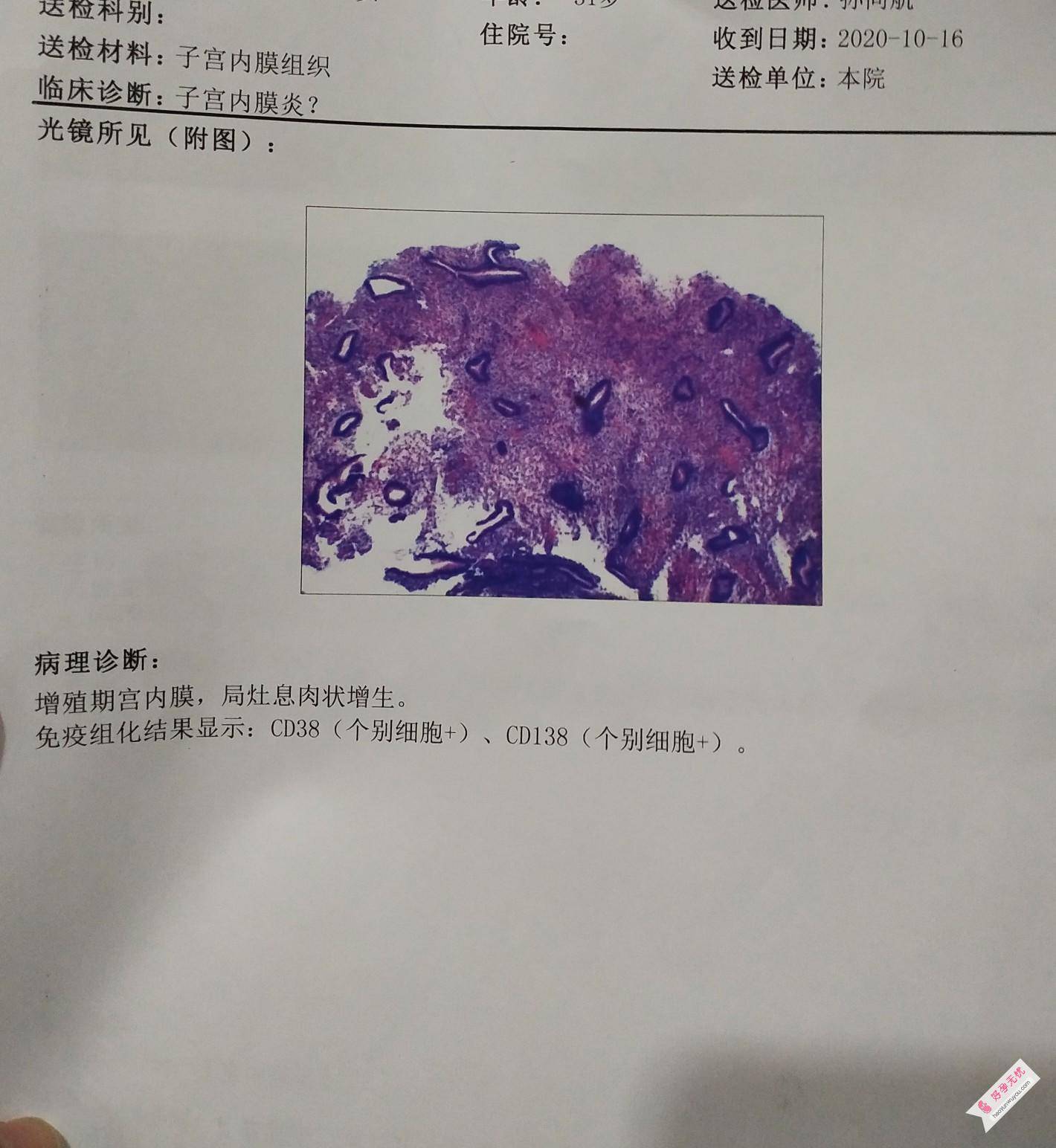 有没有做宫腔镜内膜病理免疫组化cd38和cd138(个别细胞 )的呢?