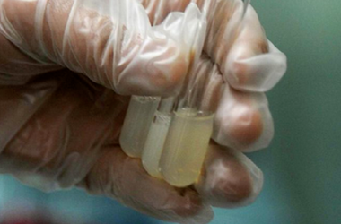 死精图片和活精对比死精能做试管吗